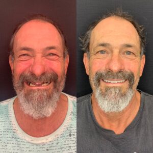 0BB6B4D8-315D-4DB2-A170-68E8E51926E8