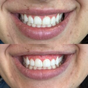 0CE64600-8909-4DE0-9672-BA50924DA866