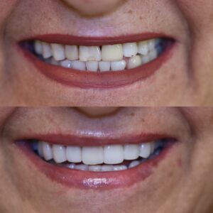 0FB4A6BC-ABD1-41EC-B1B4-2315CBE5F647