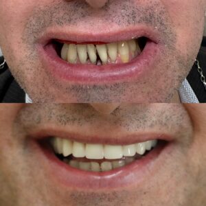 1034E675-D81D-45F7-A93F-DA4B6EB026EF