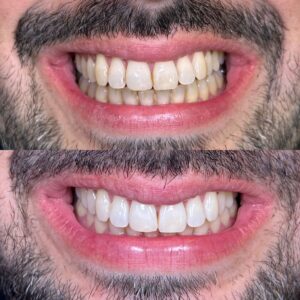 13A3D1B2-D141-4833-A98C-556AC20036C5