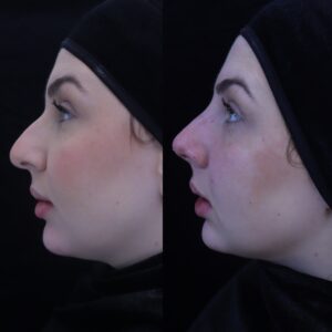 156BA691-3779-4EC8-84A1-0D4DC2A2054E