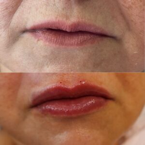 183B860F-4258-41C2-AAB1-35A2E027E70C