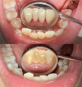 1AF39F86-C59B-4FE0-8B6D-E9E3712AB35A