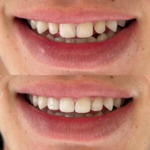 1BACE989-0F05-4537-868F-ED0AD3E6C162