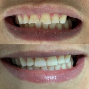 1C629446-CA02-495D-8DDF-B849120E496D