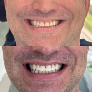 2EE0189E-C5CF-41BA-9F93-4B4097D809C8