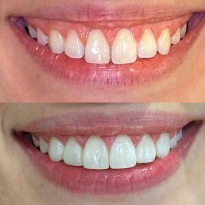 304CEC63-7433-43FF-99D2-2F097F83A9E6