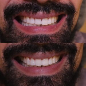 3291E750-D916-4865-A05B-C76D107E4BBD