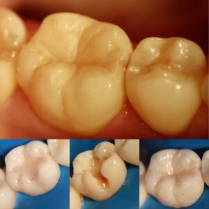 32F6F0AC-5B57-4C59-AAD3-E9B583442CDE