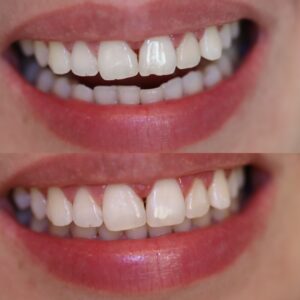 37B4372C-3E60-4302-A8D0-1FAD57B91E20