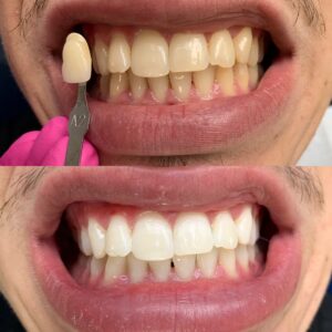 3CBC55FB-EEA0-454D-BF2D-2E95C762DF46