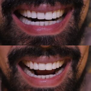 453BA85A-7CAB-49C2-91FD-0A8F65551345