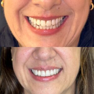 4E292B68-9489-4D7B-95B2-6DF7AE8E78A7