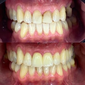 537B8167-4C58-4E16-AF5F-9FB10D3B867E