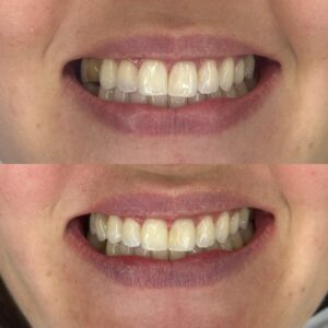 56321E6E-A166-428C-96E2-D1F660B6A506