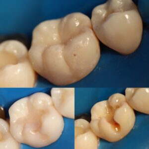 587B5726-4F71-41DC-8DD3-16C7FD7BEE50