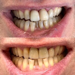 6F515F37-31FC-4428-B725-0CE6F3EC4D04