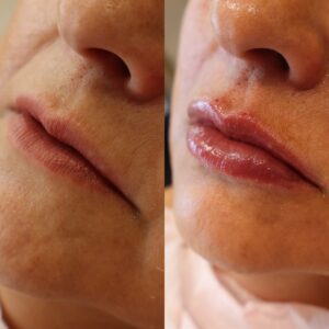 7460DC9C-F6B6-4DC4-B69E-49D9AD5E15E9