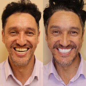 7AD7816C-5989-489D-9637-15132B0E1446