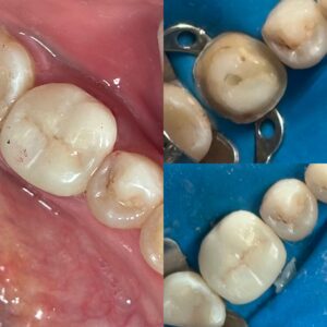 81971364-5F8B-472B-9B41-8B94FD52AAFB