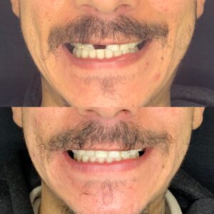 840791B6-2FBB-47CD-8023-7F1B9C49042D