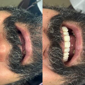 8E6ACAD3-52CA-4575-BBDB-1782FC0AC02E