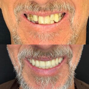 8F7B911F-C920-4823-8135-F2BA86084CA6