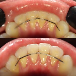 92778859-2E07-40BE-834E-A790ECE144EE