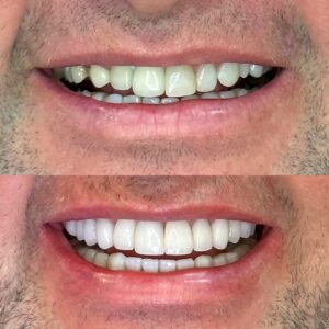 96E87501-B64B-46AC-9709-5B364A8B21B4