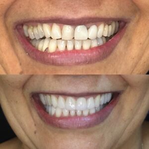 9F16643E-F47E-4632-94F3-C2639BA8E1E7