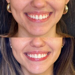 A87F9B23-9F5A-4085-8CCE-277C5062E140