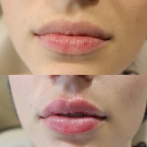 D1D13D41-50F6-42FE-9AB1-5A2C68251C74