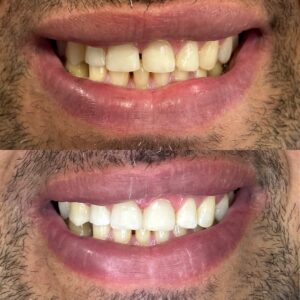 E0A13743-E6D1-4BA0-94A2-11067AEC6B9F