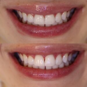 E2A933AF-1FE6-4201-A374-E21B00D6A841