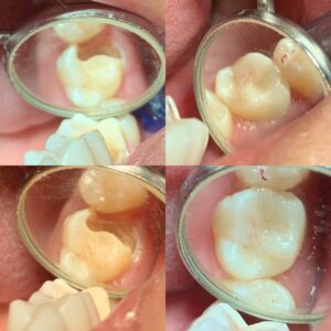 E33BB48F-2A6E-4CC9-8B8D-DD02BA1842B3