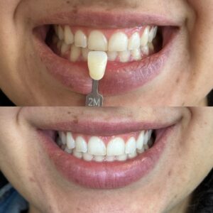 E9980A6B-8E87-4506-91AB-B96D62928610