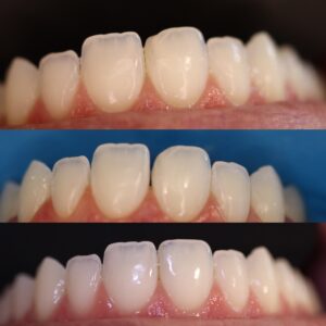 F82FFDB0-5ED4-4476-8A40-FFFFA21A26AE